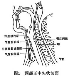 气管前间隙感染