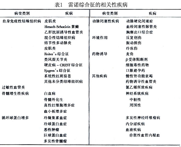 雷诺综合征_雷诺综合症