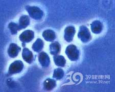 球孢子菌病 部位:全身 科室:呼吸内科,风湿科,心胸外科,传染科 症状