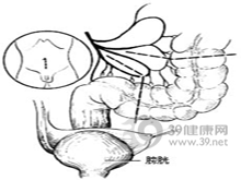 5dd56735cca.gif