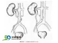 孕期可以吃红豆和绿豆利水消肿吗