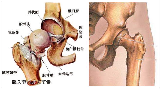 治疗缺血性股骨头坏死