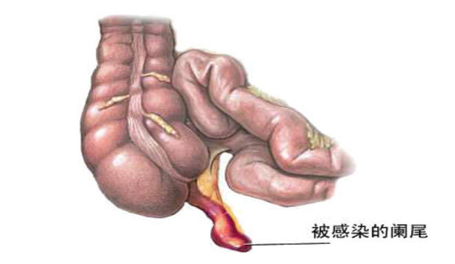 病人口腔水_艾滋病人口腔图片(2)