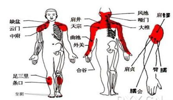 肩周炎