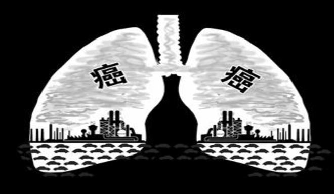 肺癌