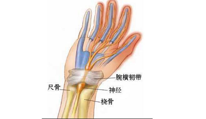 人均腱鞘炎_手腕腱鞘炎图片(2)