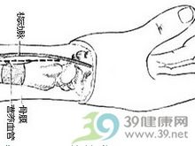 吻合血管的桡骨骨膜切取术