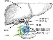 总胆管切开摘石术及t形管引流