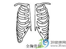 胸骨裂缝合与修复