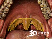 腭舌咽呼吸肌呈对称性弛缓性轻瘫