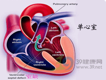 器质性心脏病