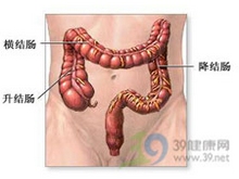 肠管变形