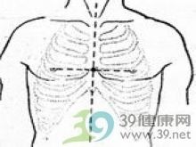 胸腔出口综合征