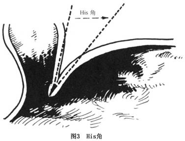 his角解剖图图片